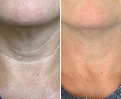 Before and after transformation result