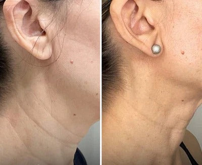 Before and after transformation result