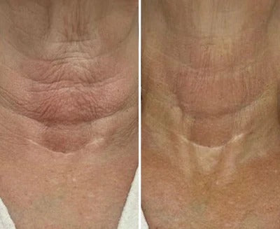 Before and after transformation result