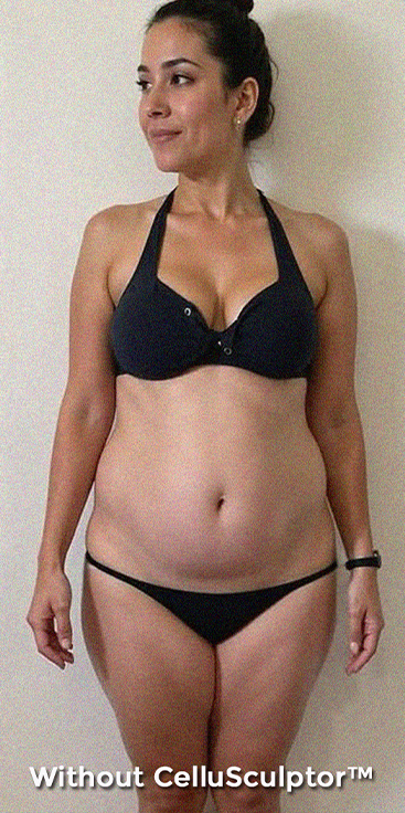 Before - Sophia