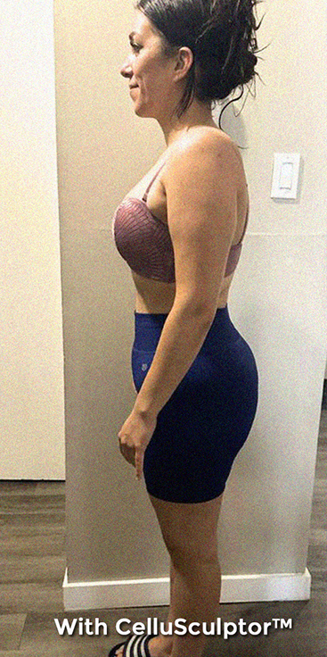 After - Laura