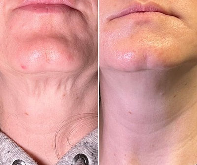 Before and after transformation result