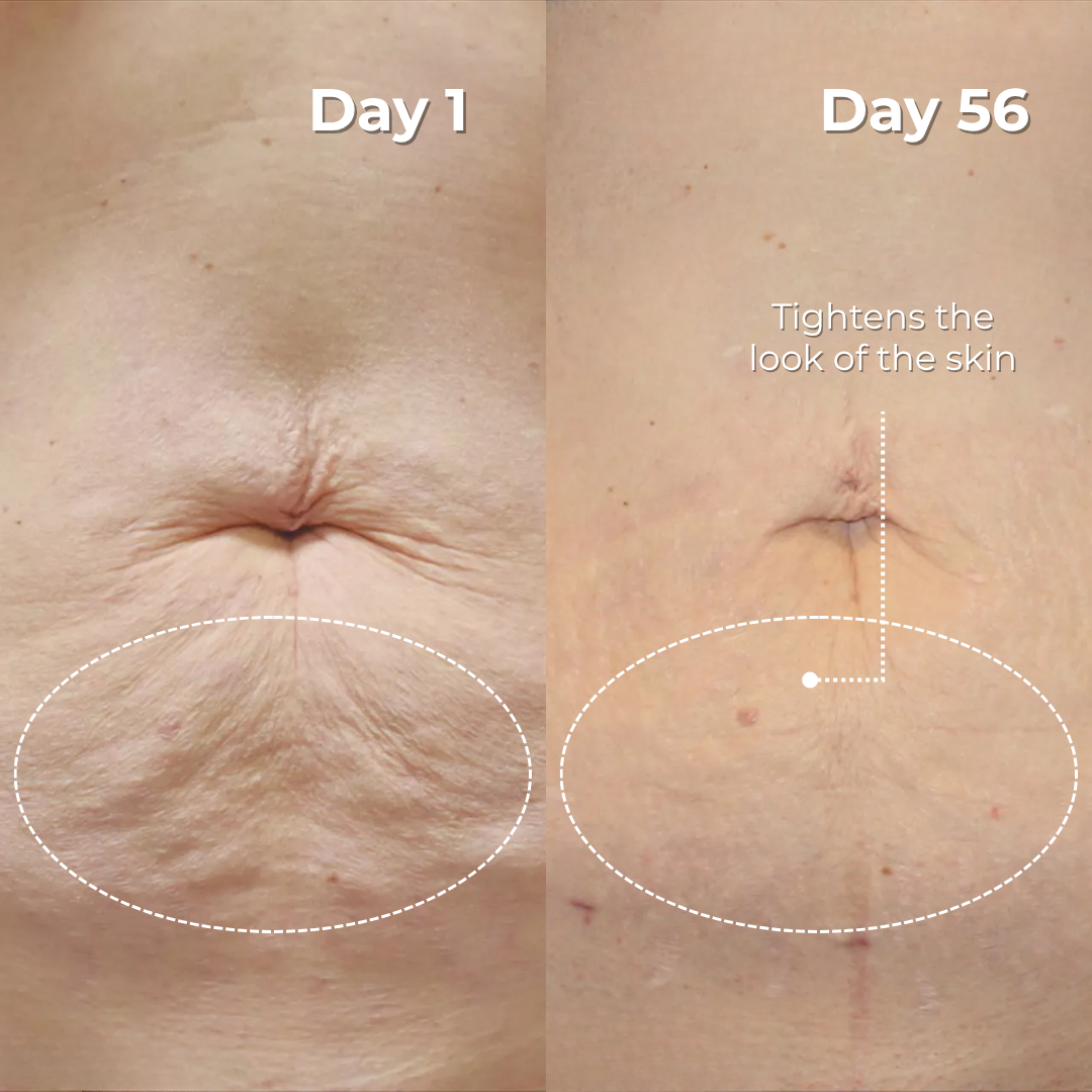 Tighten & Lift Neck Cream